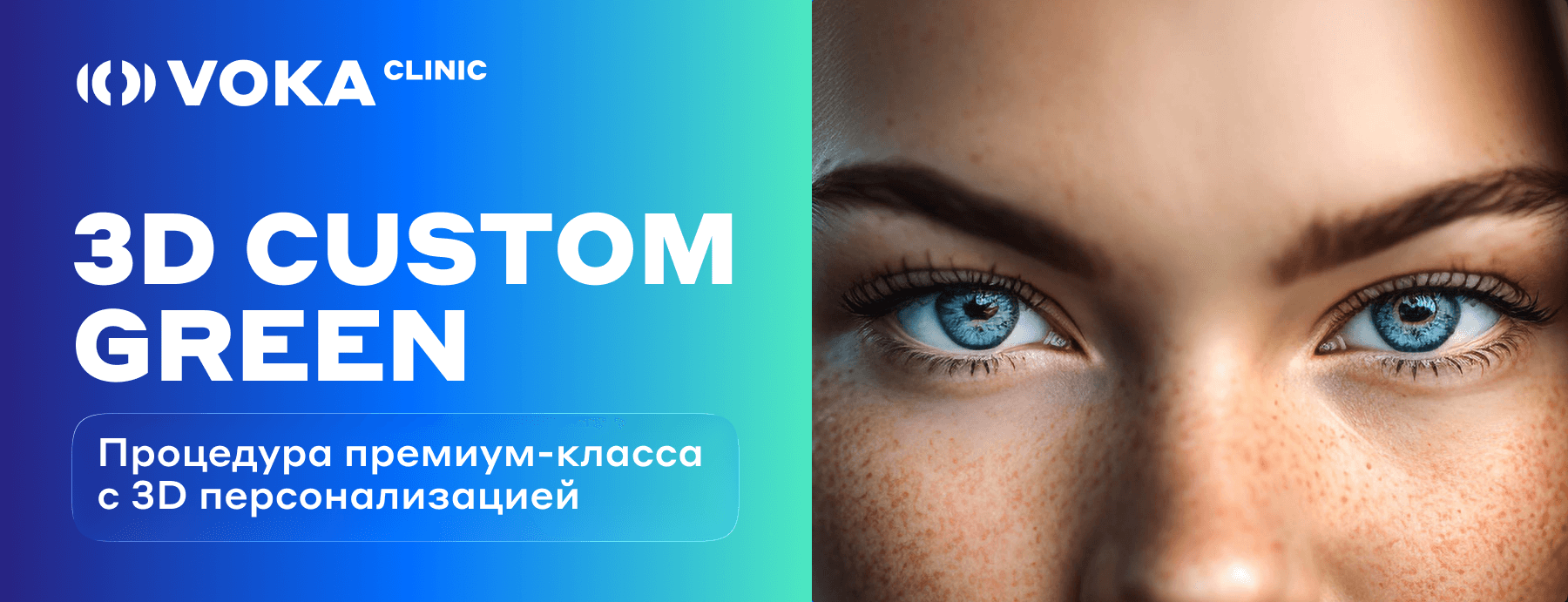 лазерная коррекция зрения